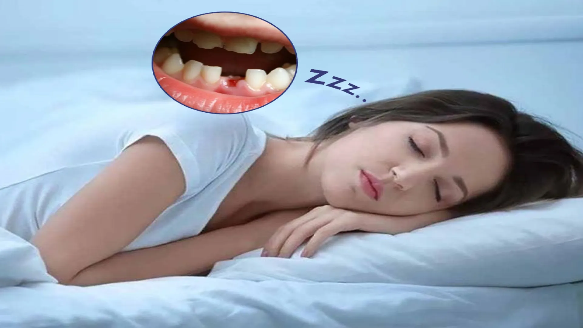 Mơ thấy rụng răng chảy máu Mơ thấy rụng răng chảy máu